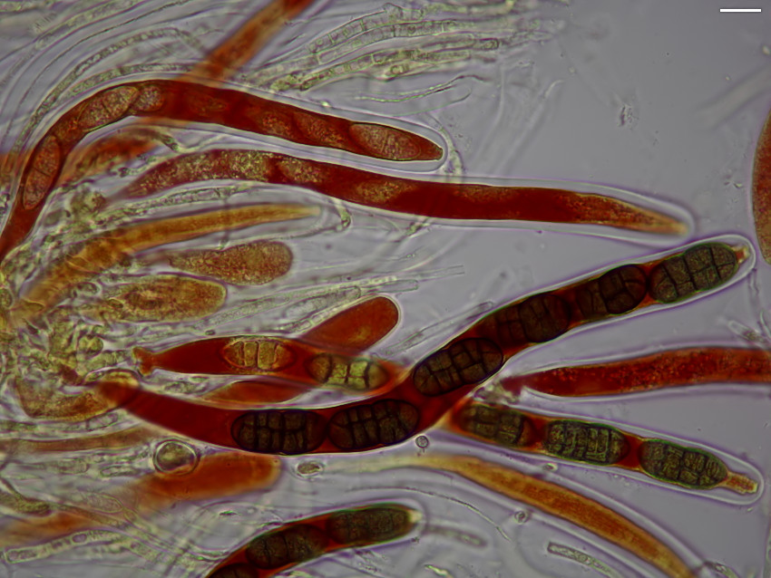 Cucurbitaria spartii