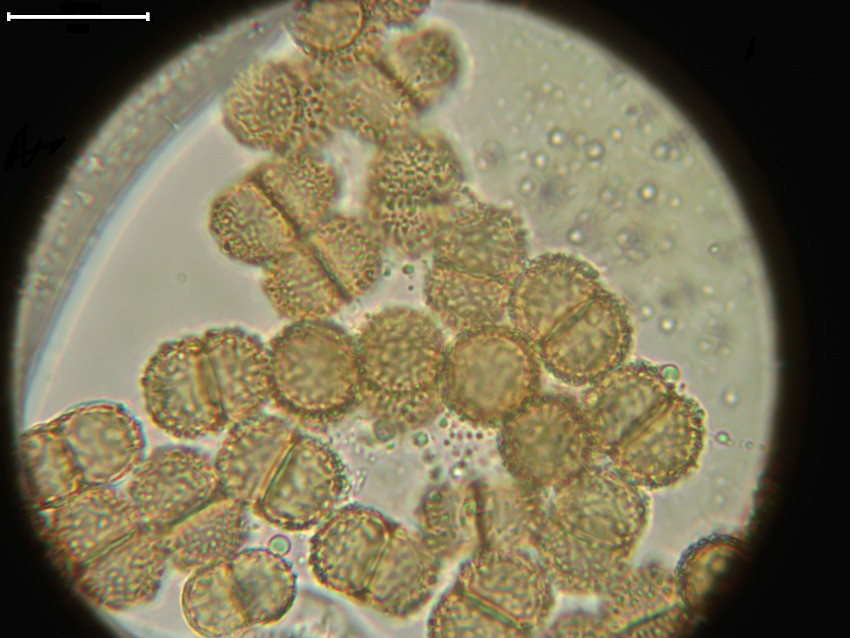 Dialonectria cosmariospora