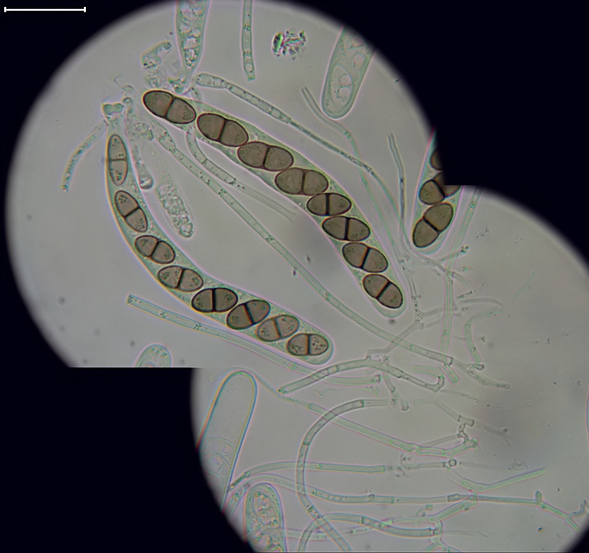 Didymosphaeria futilis