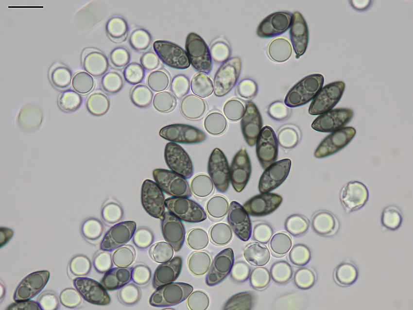 Helminthosphaeria clavariarum