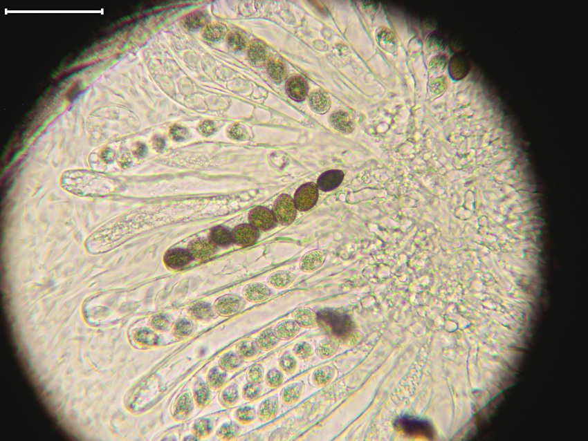 Jugulospora rotula
