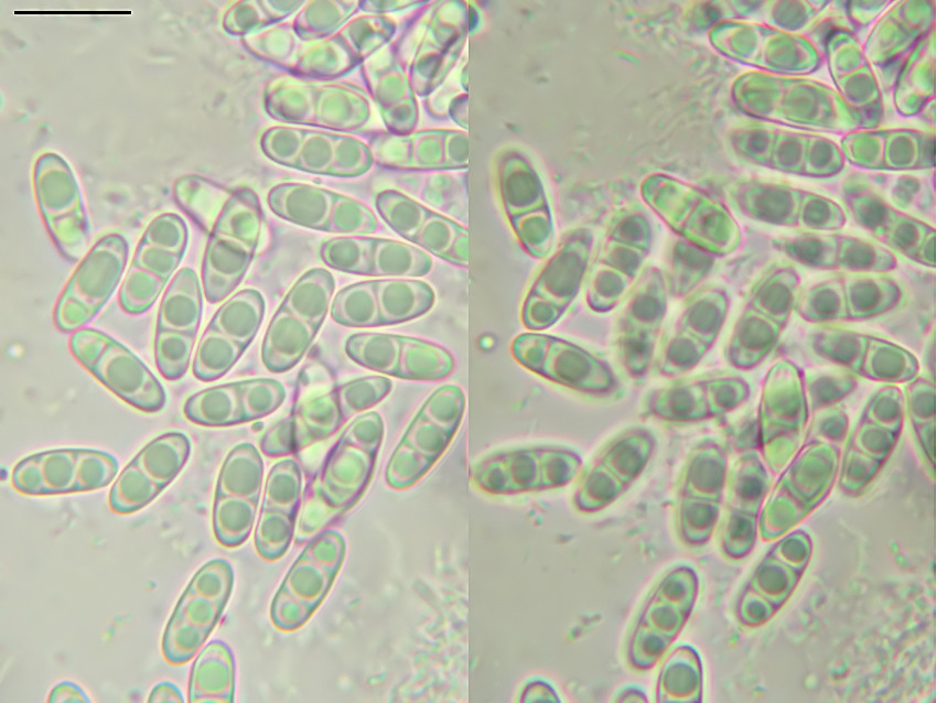 Lentomitella conoidea