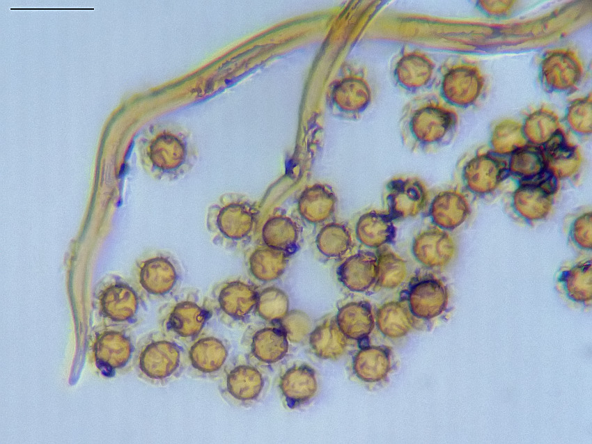 Myriostoma coliforme