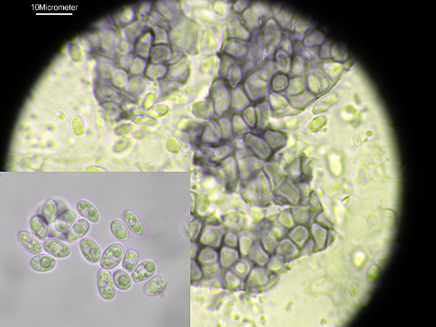 Rhizosphaera kalkhoffii