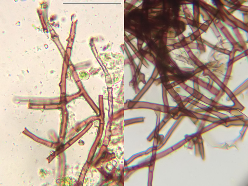 Rosellinia corticium