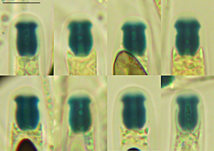 Rosellinia corticium