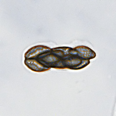 Saccobolus versicolor