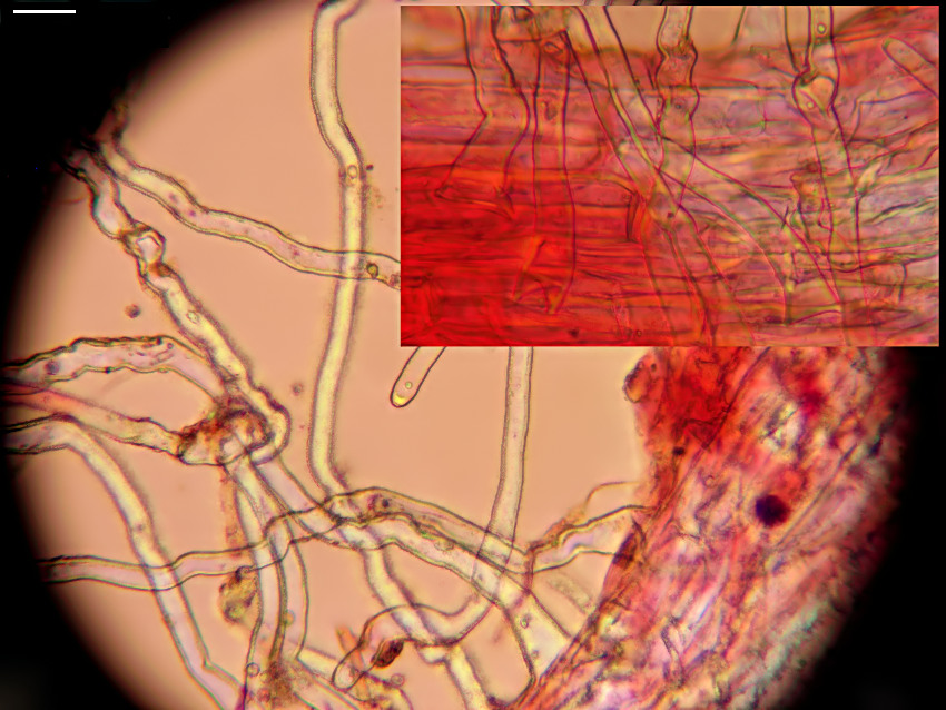 Scleroderma verrucosum