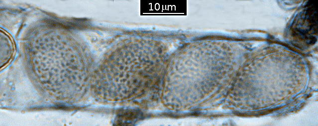 Scutellinia subhirtella