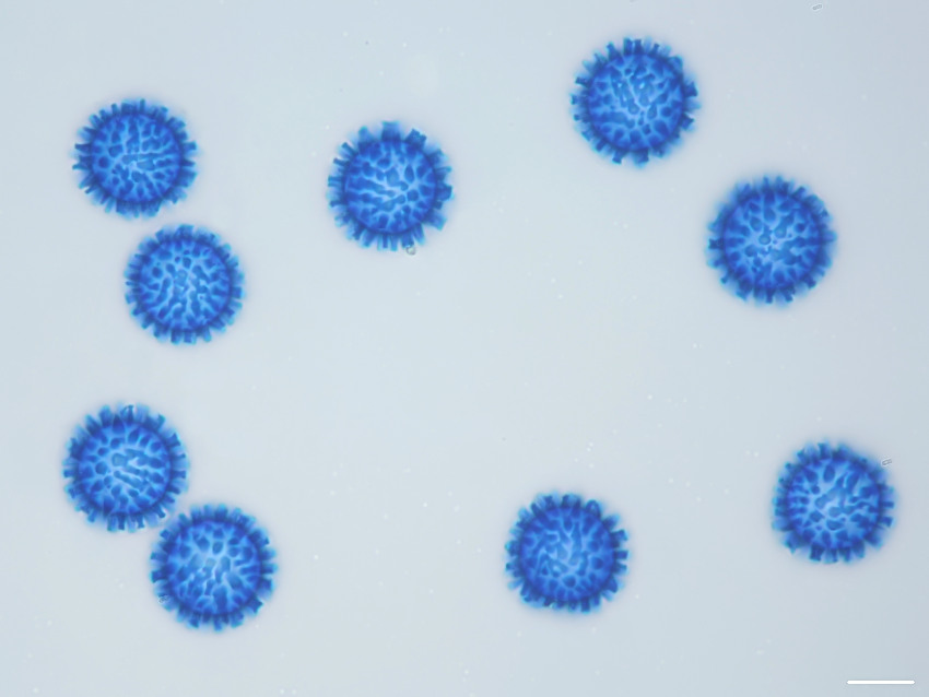 Scutellinia trechispora